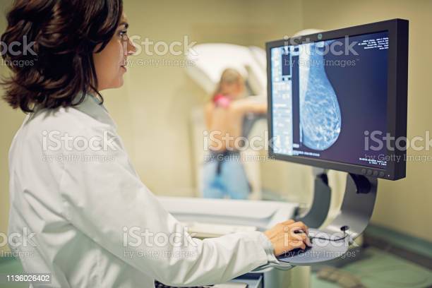 Illustration of a mammography screening machine with the text "Mammography Screening Guidelines" in bold letters.